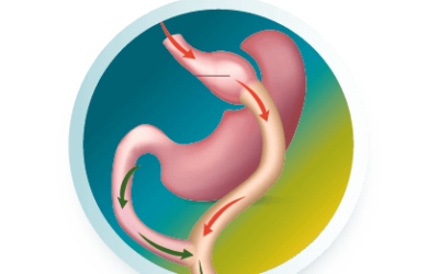Corrective surgeries after bariatric surgery