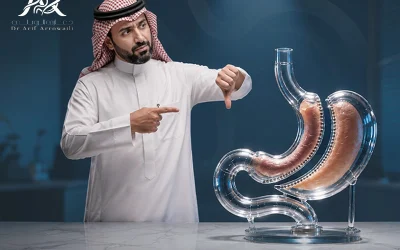 مخاطر عملية تكميم المعدة التي يجب معرفتها قبل الجراحة