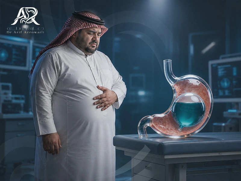 مضاعفات بالون المعدة